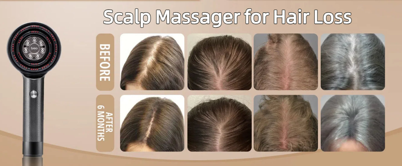 Scalp Massager for Hair Loss: 2025 Complete Guide Breo-Official Scalp Massager for Hair Loss: 2025 Complete Guide Breo-Official