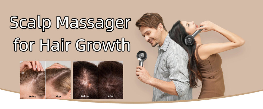 2025 Best Scalp Massager for Hair Growth [Science-backed]
