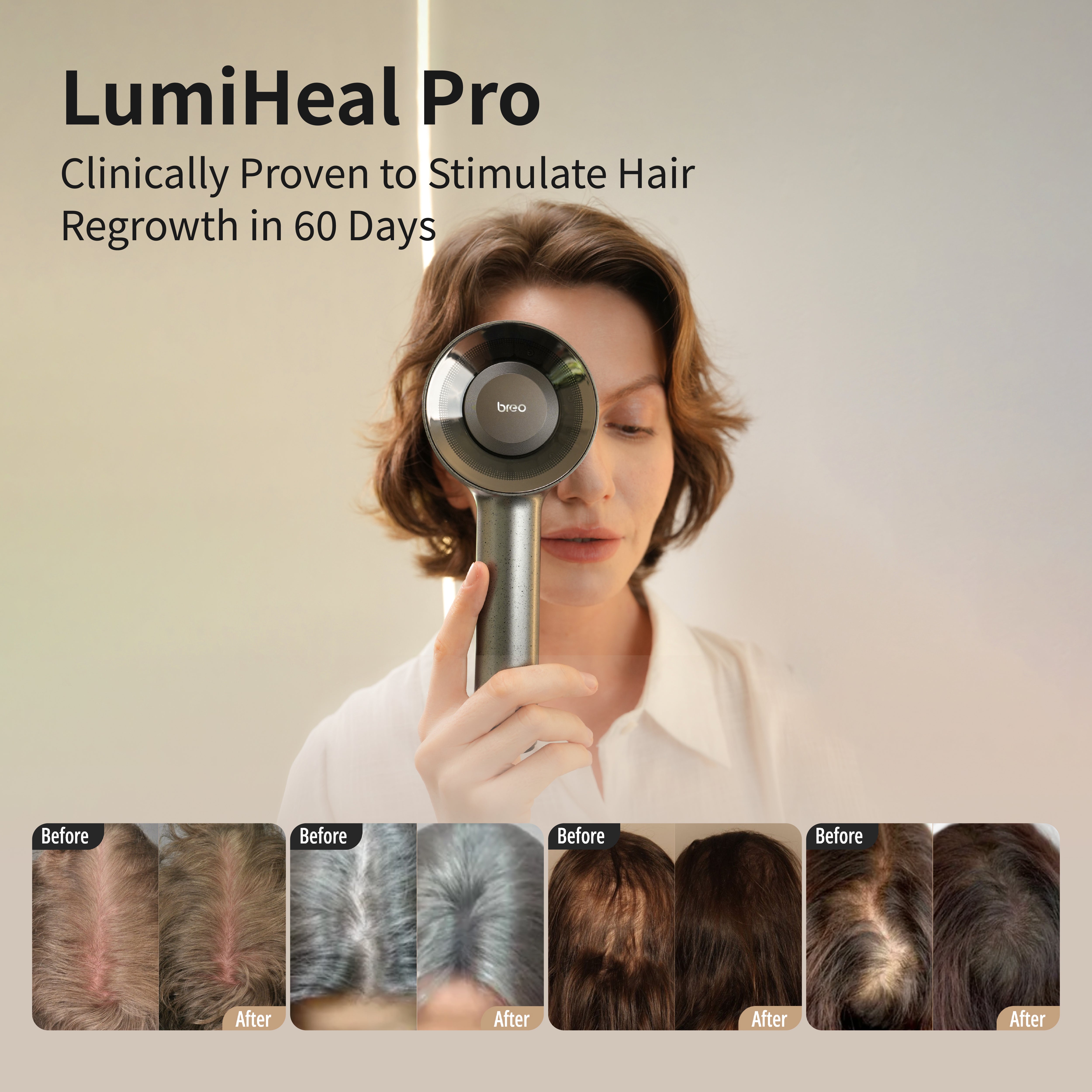 FDA) Low-level laser therapy (lllt) Scalp Massager for Hair Growth